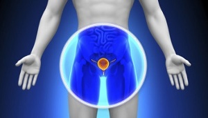 treating prostatitis with medications