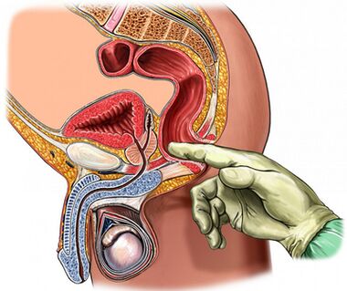 Finger prostate exam