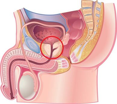 Location of the prostate in men.