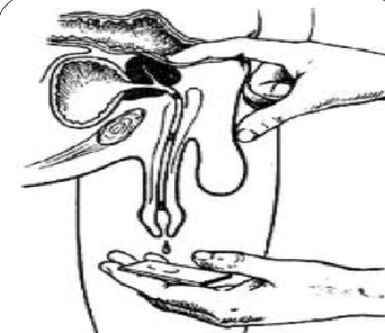 Prostate massage for discharge.