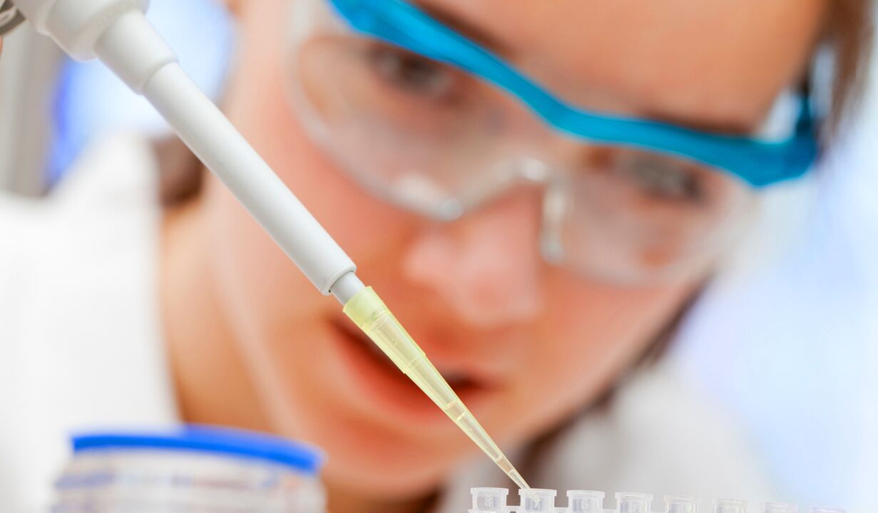 Laboratory analysis of urine a method of diagnosing prostatitis.